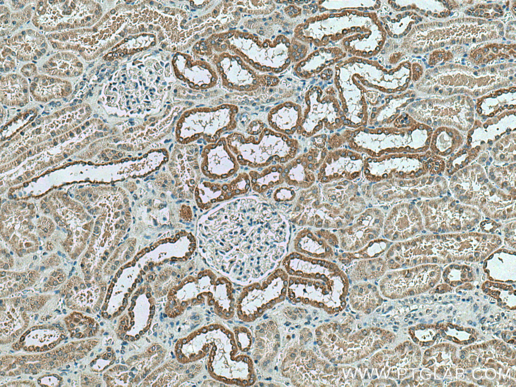 IHC staining of human kidney using 15573-1-AP