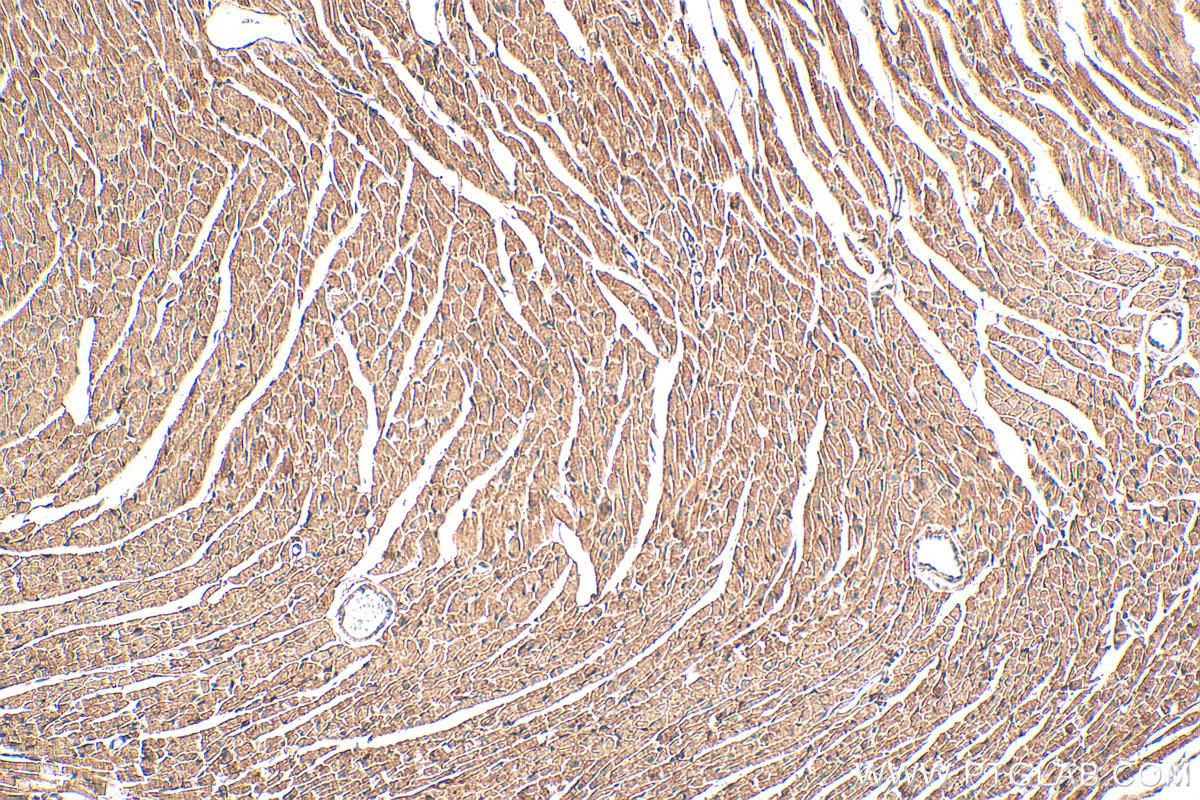 IHC staining of mouse heart using 68253-1-Ig (same clone as 68253-1-PBS)