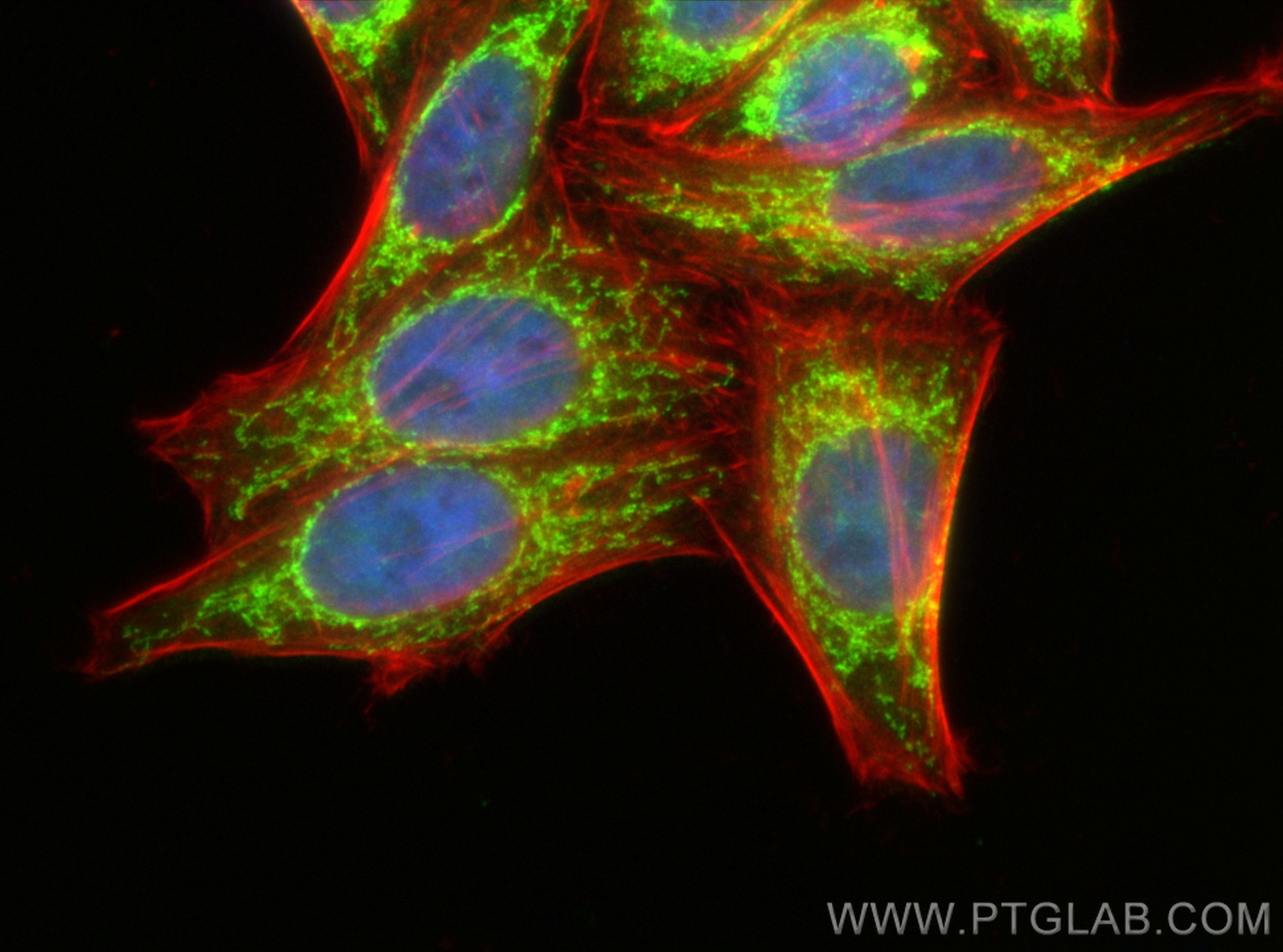 IF Staining of HepG2 using 28125-1-AP