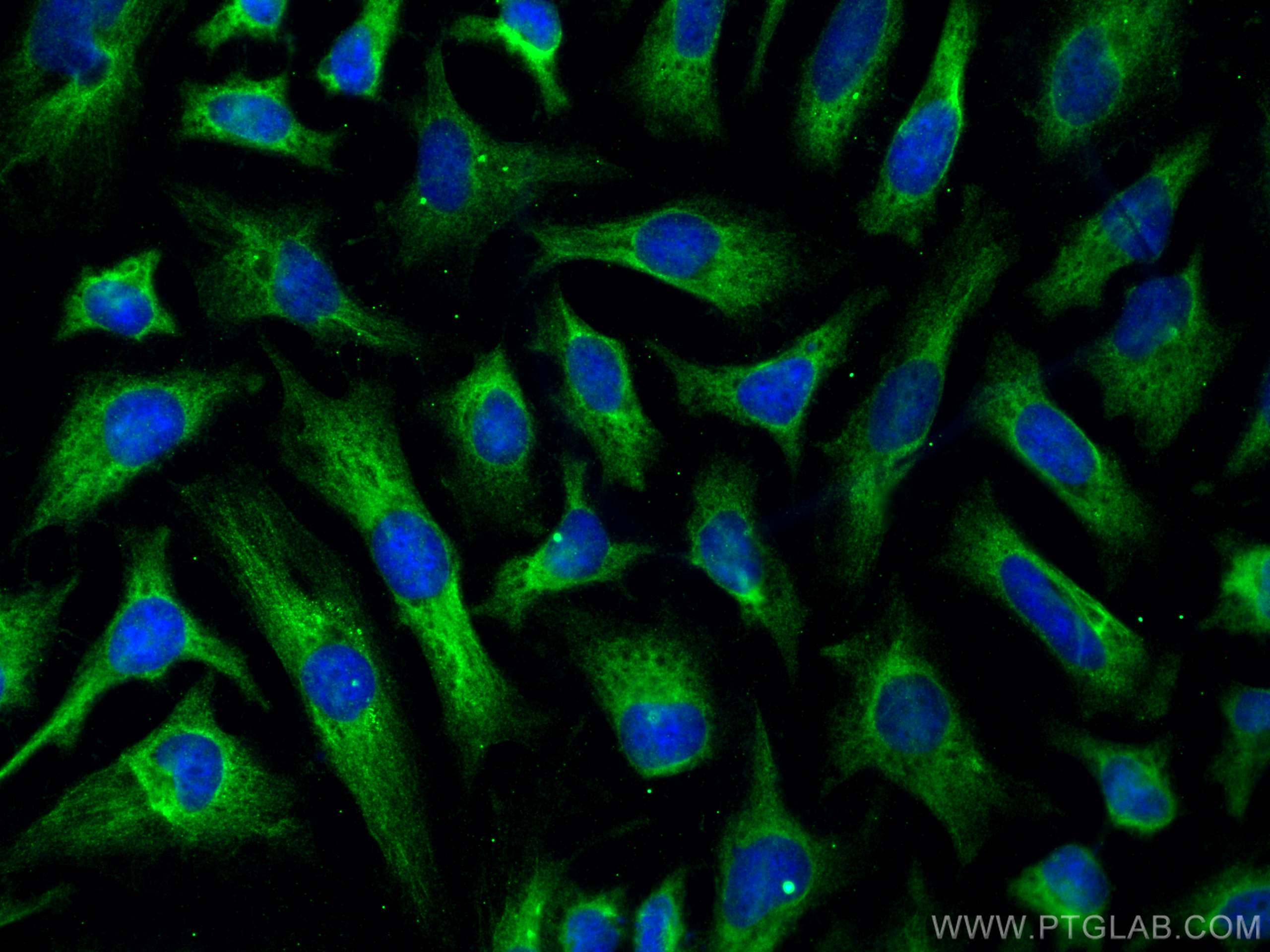 IF Staining of HeLa using 15728-1-AP