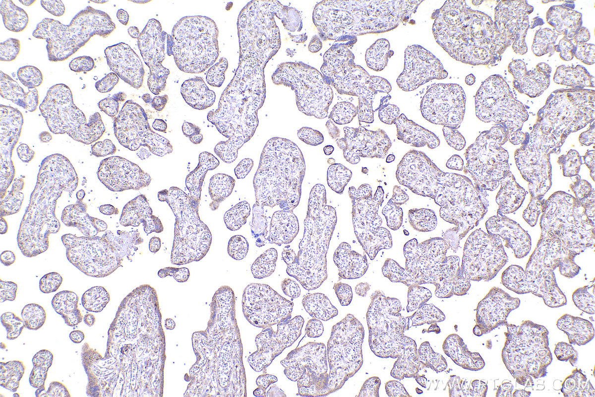 IHC staining of human placenta using 13430-1-AP