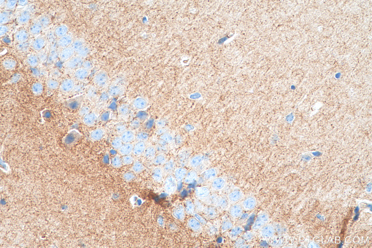 IHC staining of mouse brain using 12257-1-AP