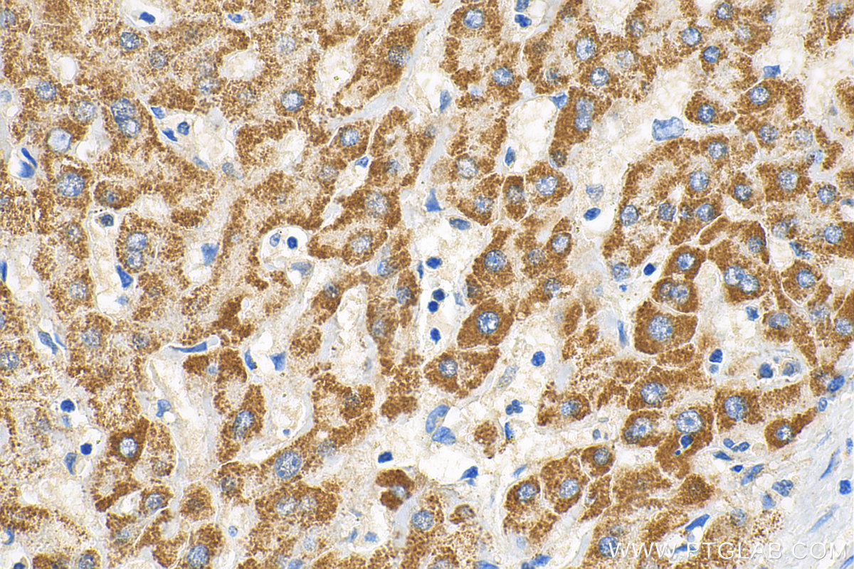 IHC staining of human liver using 13993-1-AP