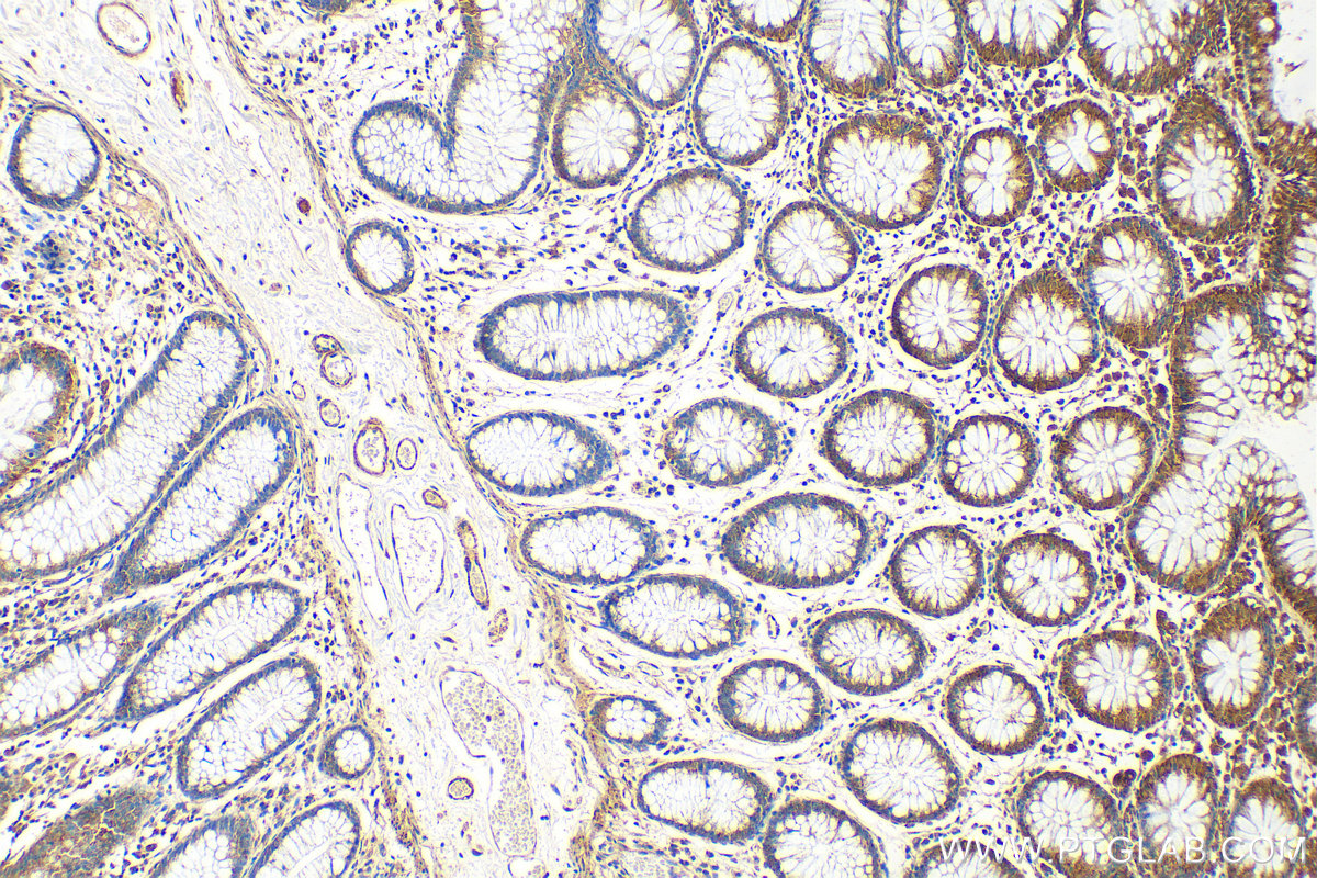 IHC staining of human colon using 13993-1-AP
