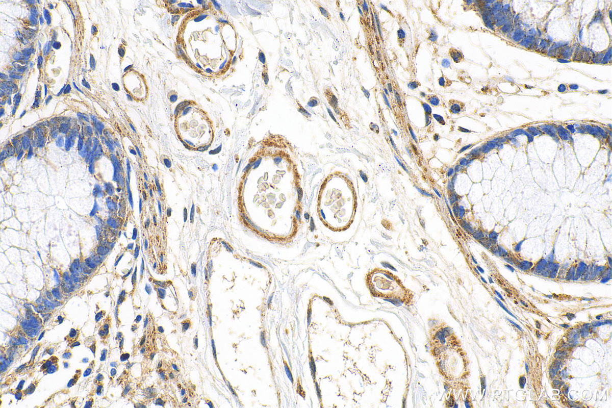 IHC staining of human colon using 13993-1-AP
