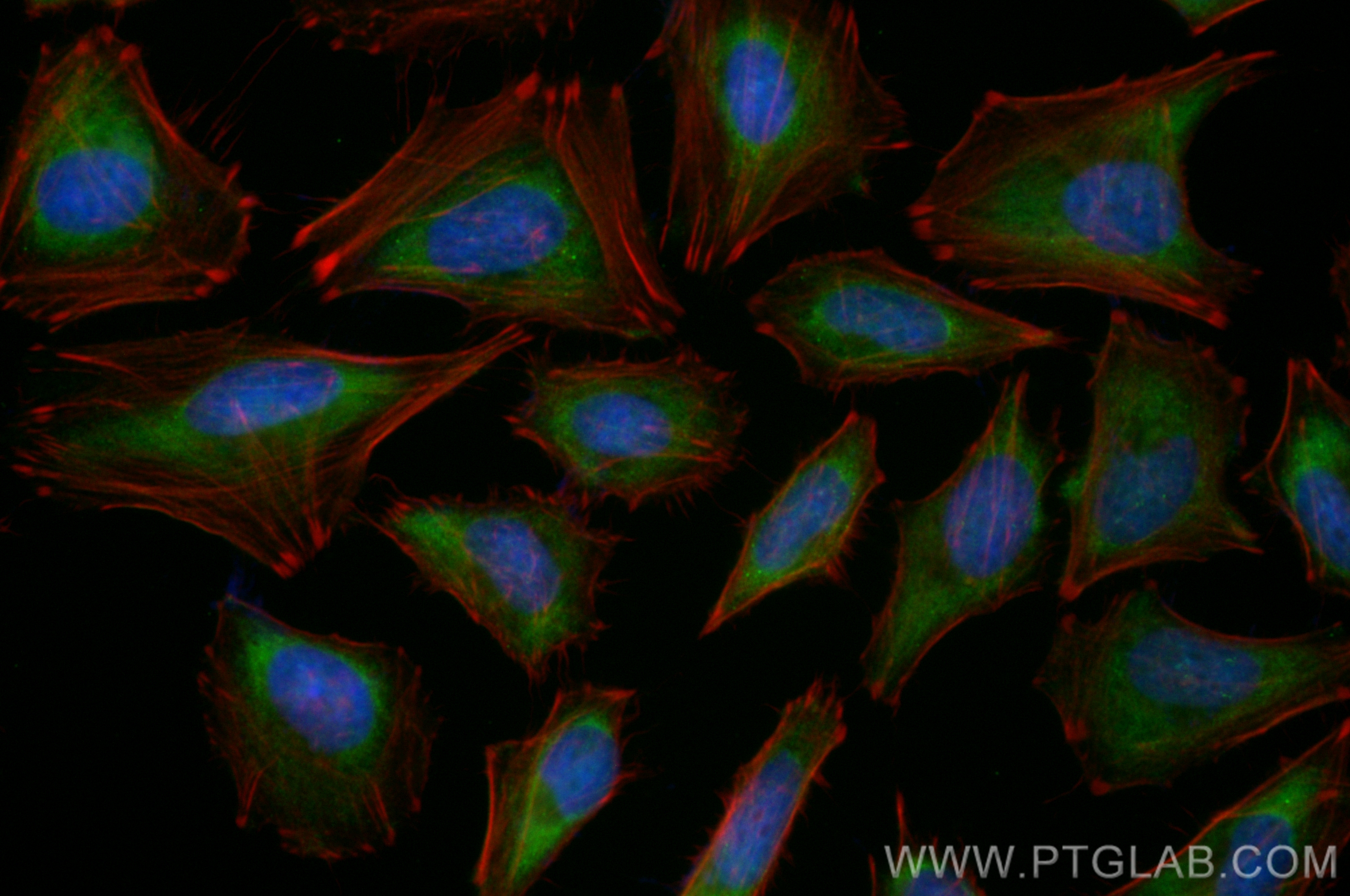 IF Staining of HeLa using CL488-83112-4