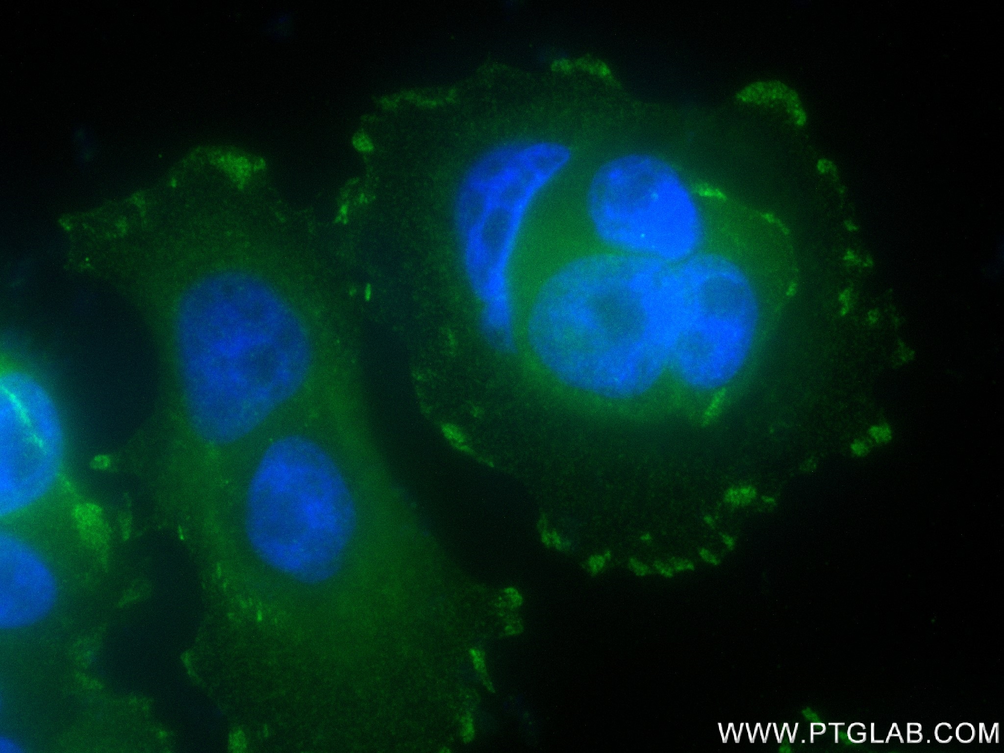 IF Staining of MCF-7 using 83362-2-RR (same clone as 83362-2-PBS)