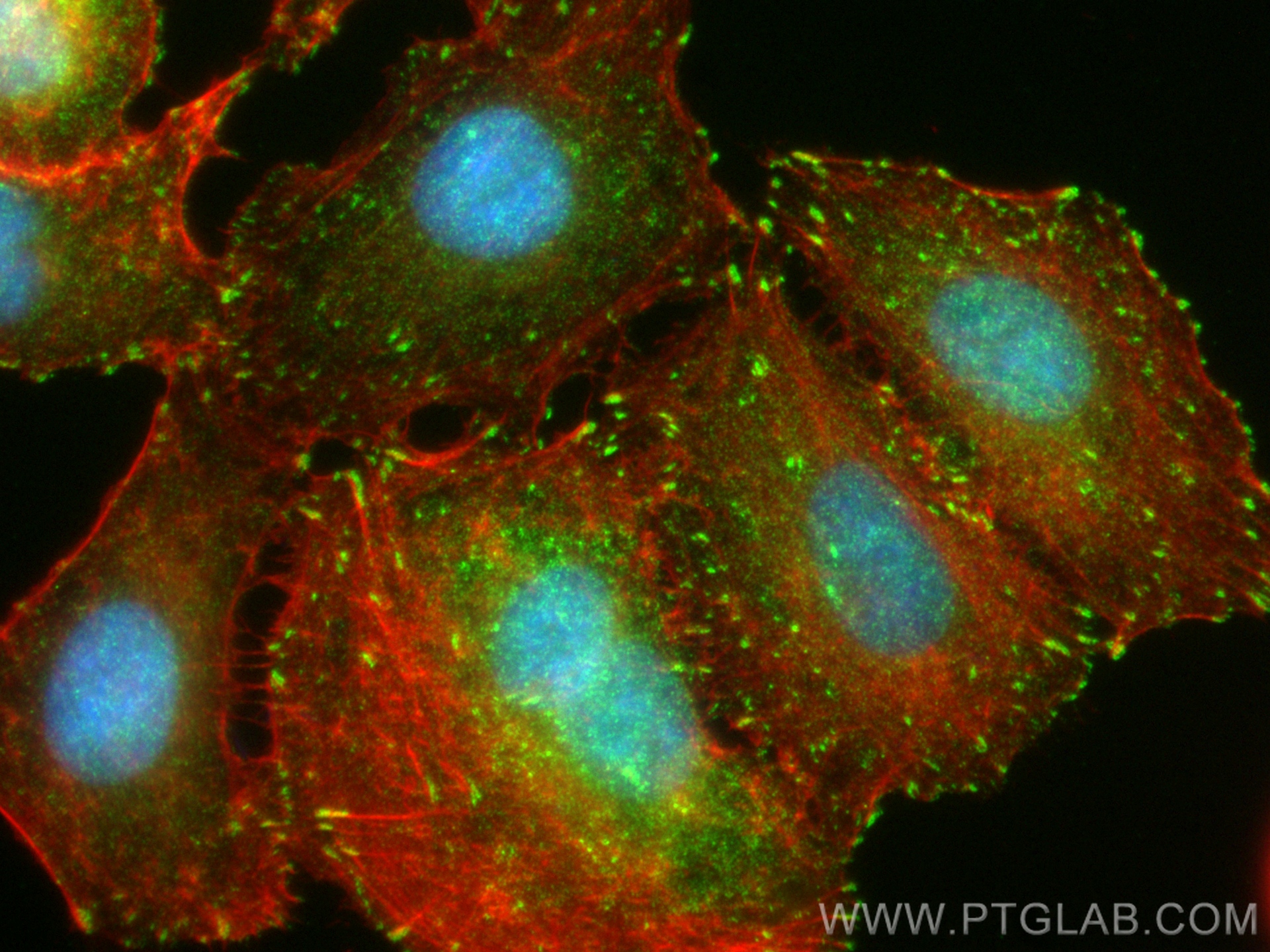 IF Staining of A549 using 83362-2-RR (same clone as 83362-2-PBS)