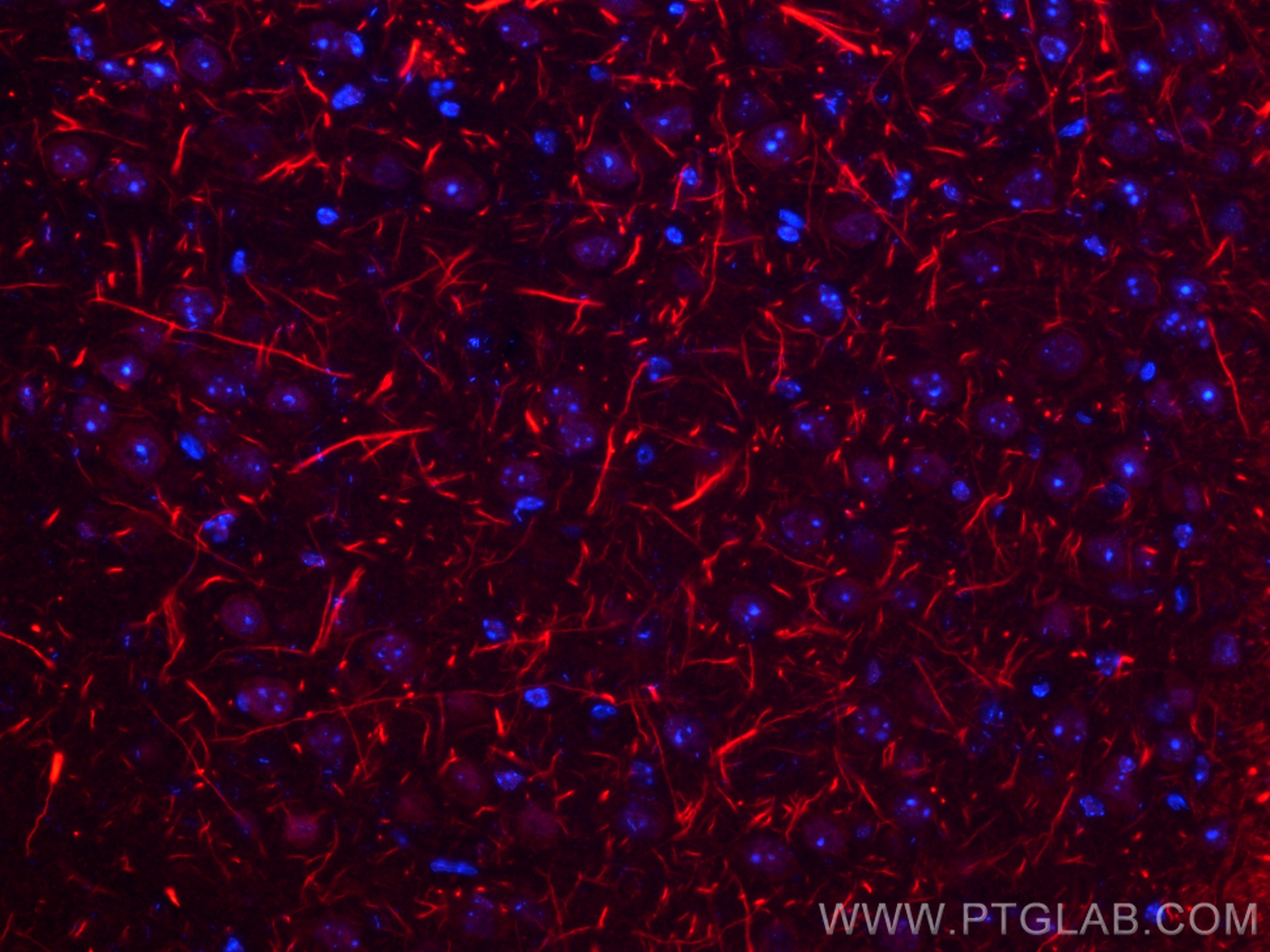 IF Staining of mouse brain using 18934-1-AP (same clone as 18934-1-PBS)