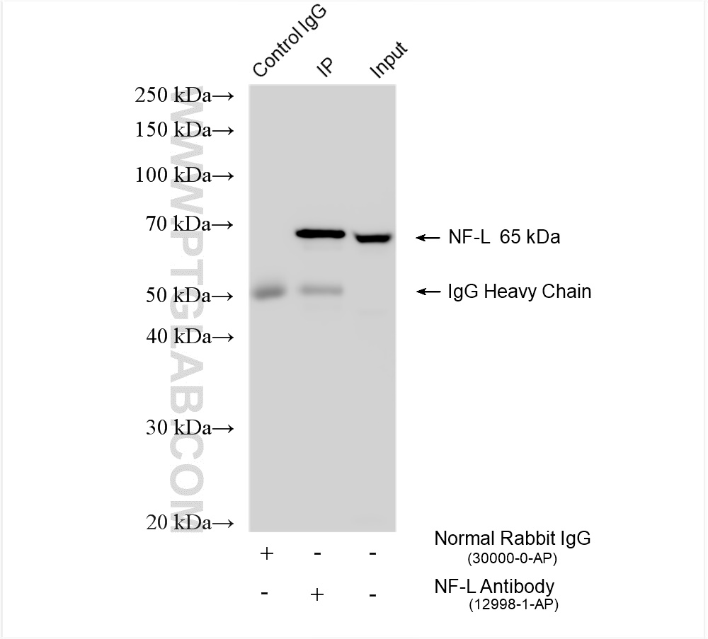 IP experiment of SH-SY5Y using 12998-1-AP