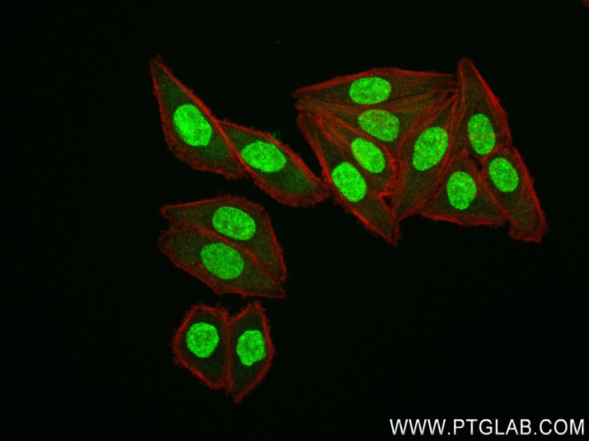 IF Staining of HepG2 using 83376-3-RR