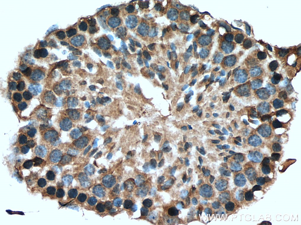 IHC staining of mouse testis using 14233-1-AP (same clone as 14233-1-PBS)