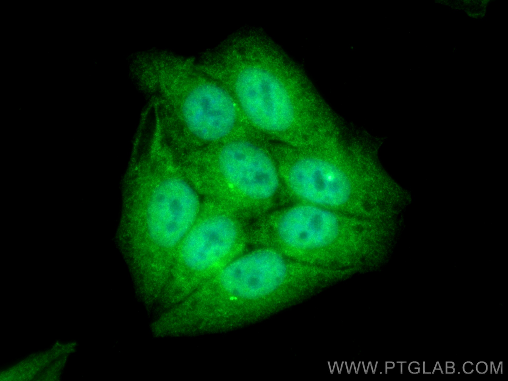 IF Staining of HepG2 using 11192-1-AP