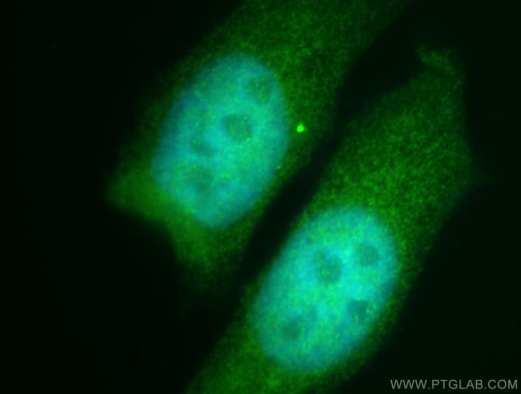 IF Staining of HepG2 using 11192-1-AP (same clone as 11192-1-PBS)