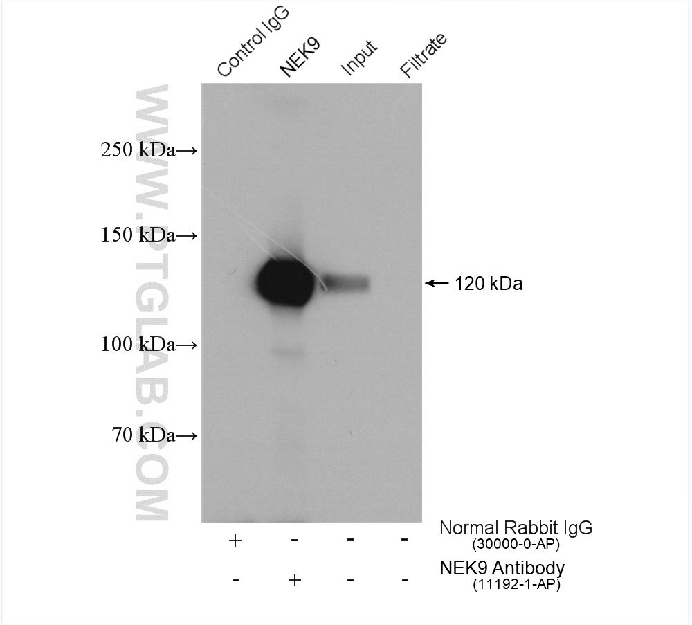 IP experiment of HeLa using 11192-1-AP (same clone as 11192-1-PBS)