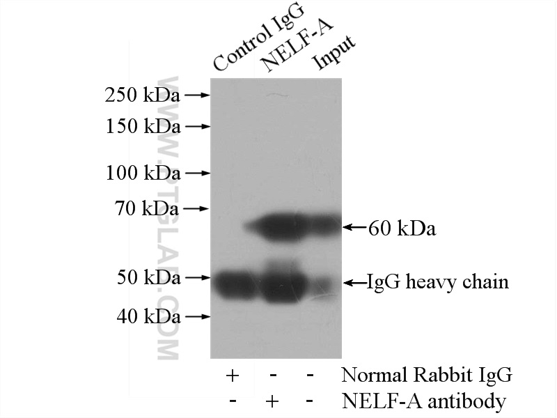 IP experiment of mouse brain using 10456-1-AP