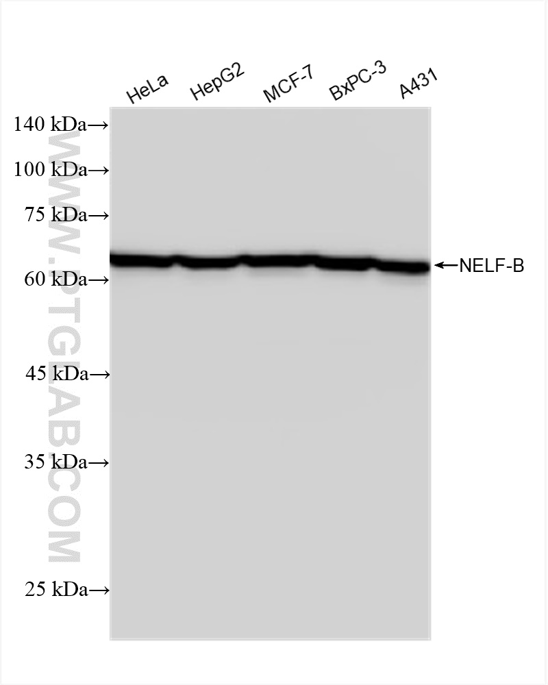 WB analysis using 84135-2-RR