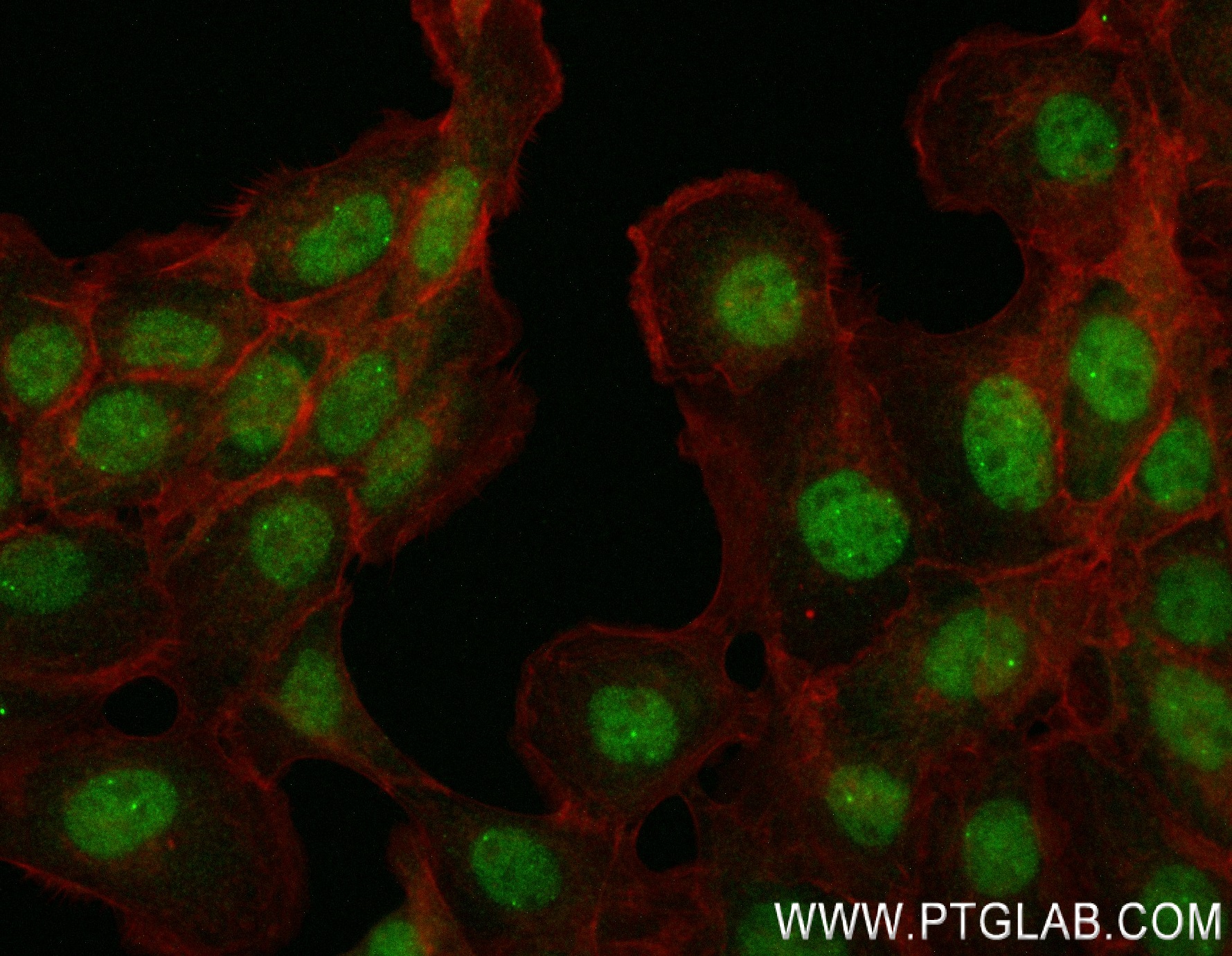 IF Staining of A431 using 84135-4-RR