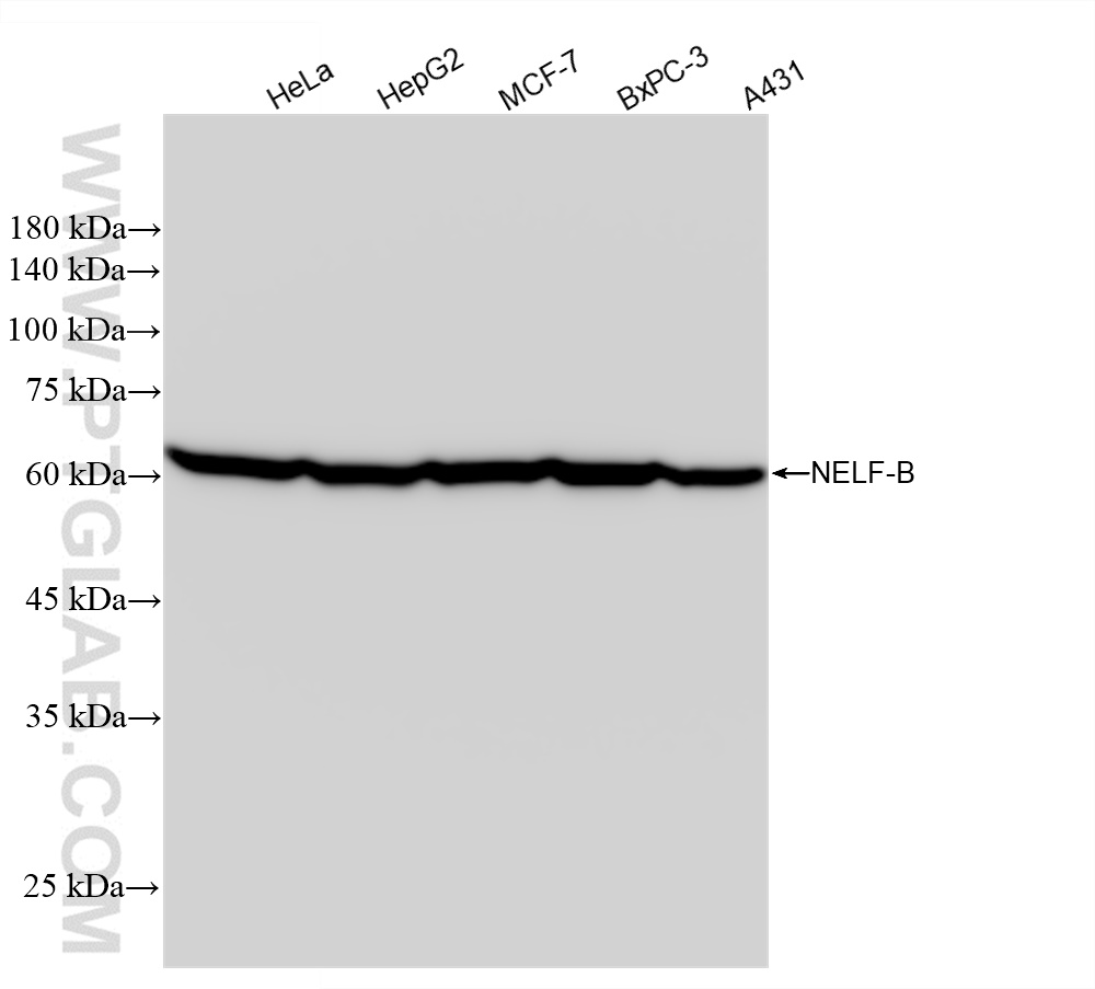 WB analysis using 84135-4-RR (same clone as 84135-4-PBS)