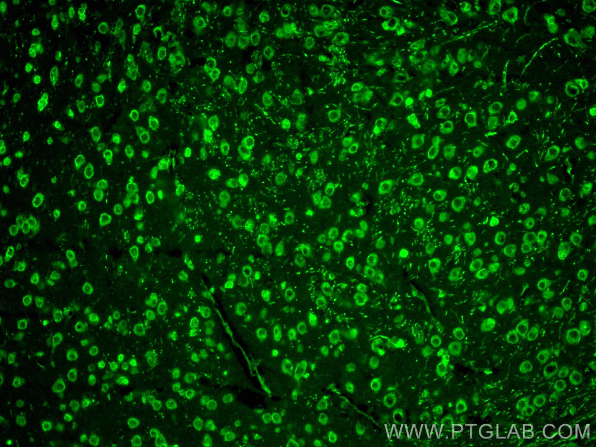 IF Staining of mouse brain using 30760-1-AP