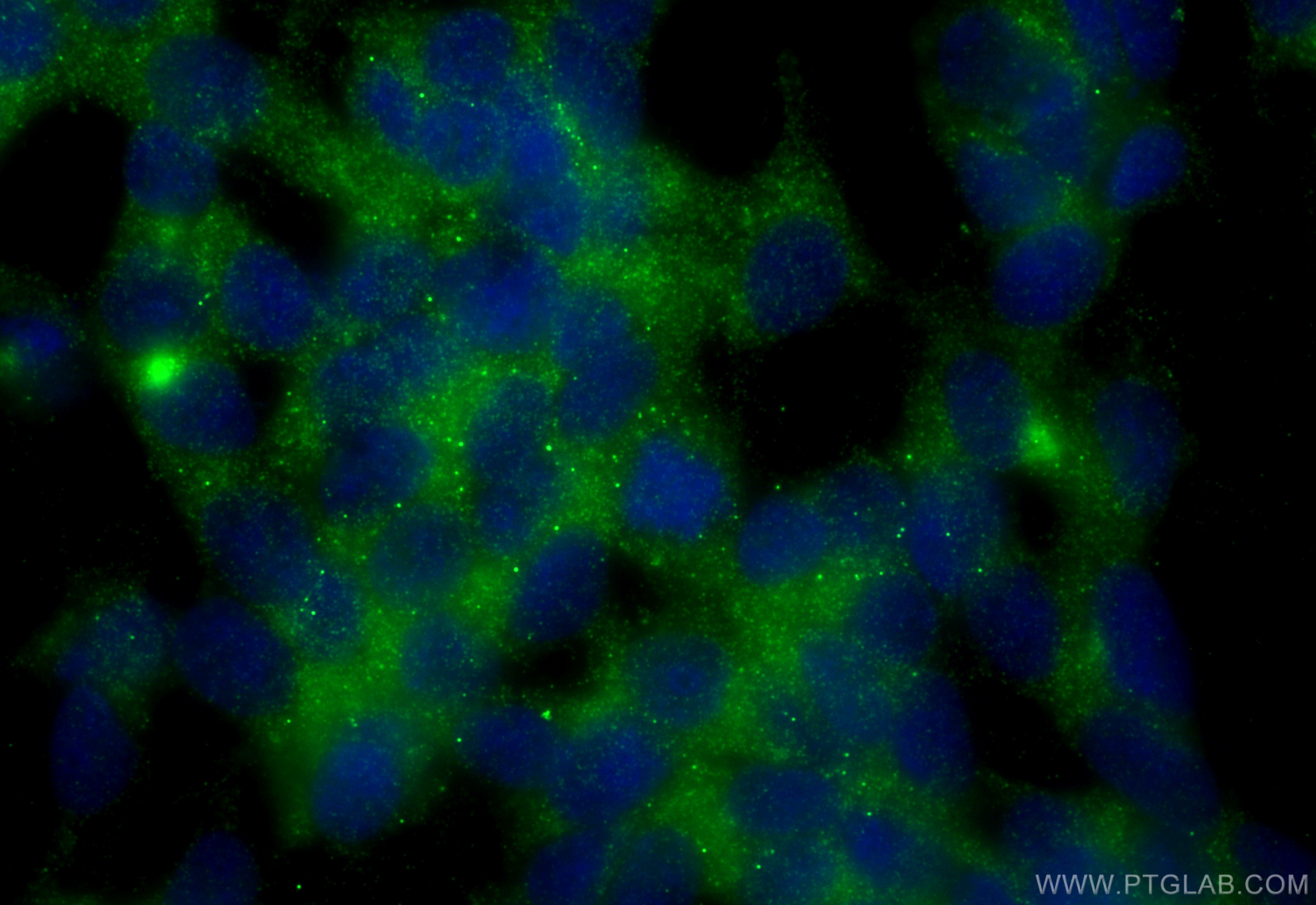 IF Staining of SH-SY5Y using 30760-1-AP