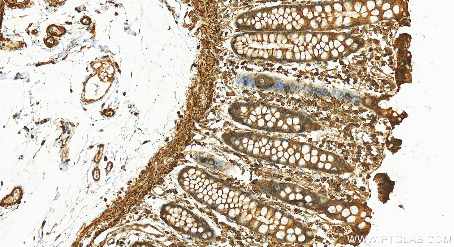 IHC staining of human colon using 10150-2-AP