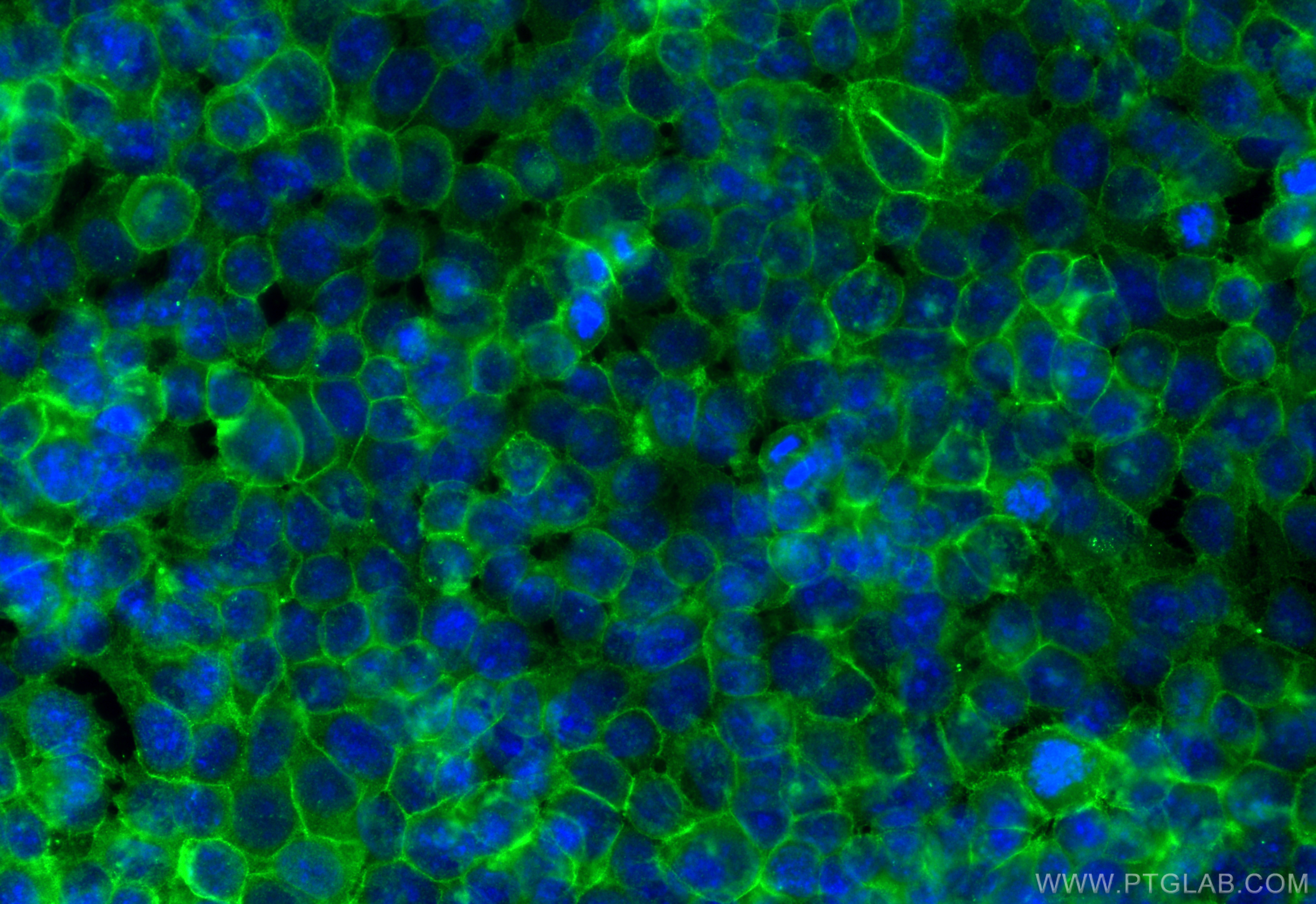 IF Staining of MCF-7 using 10150-2-AP