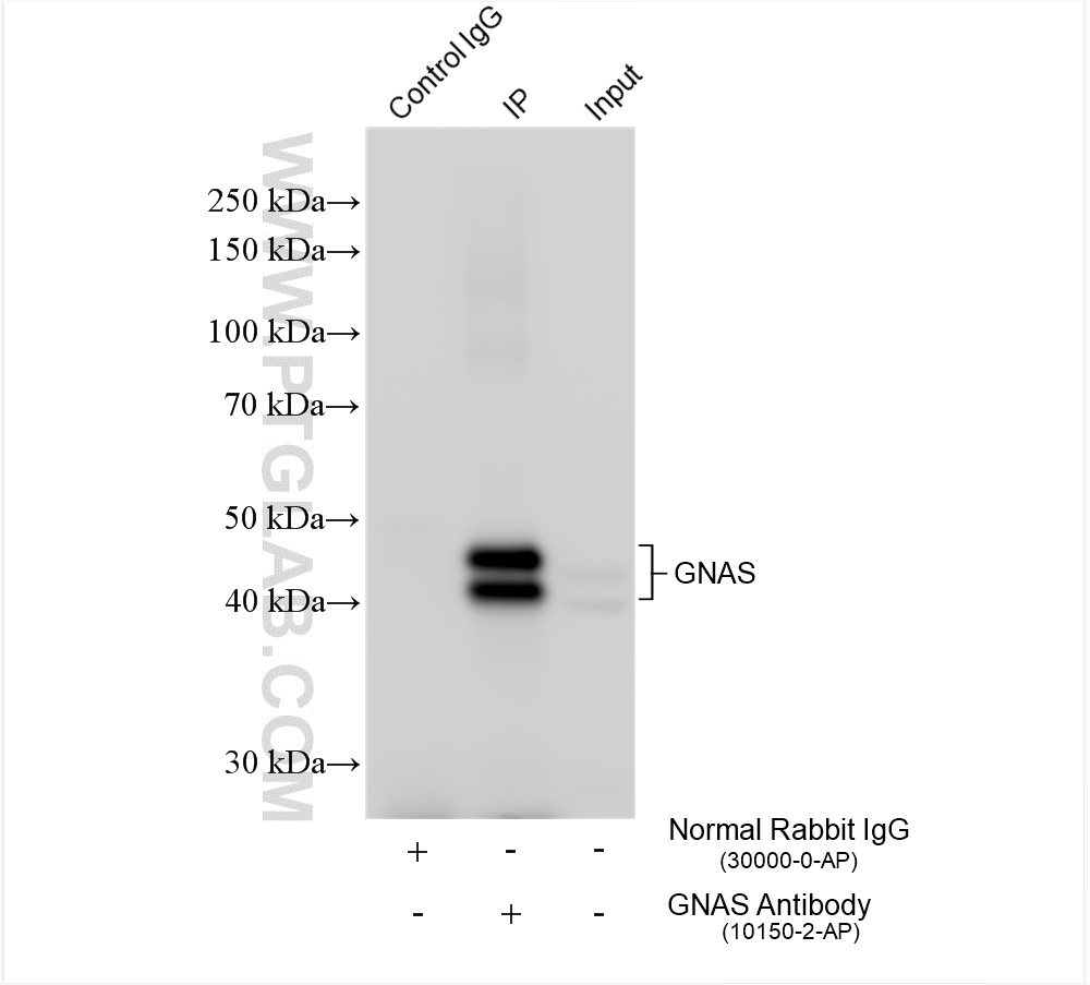 IP experiment of mouse liver using 10150-2-AP