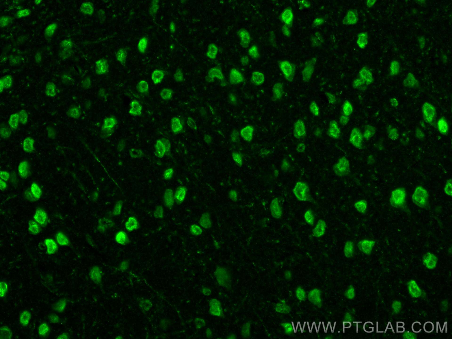 IF Staining of mouse brain using 28180-1-AP