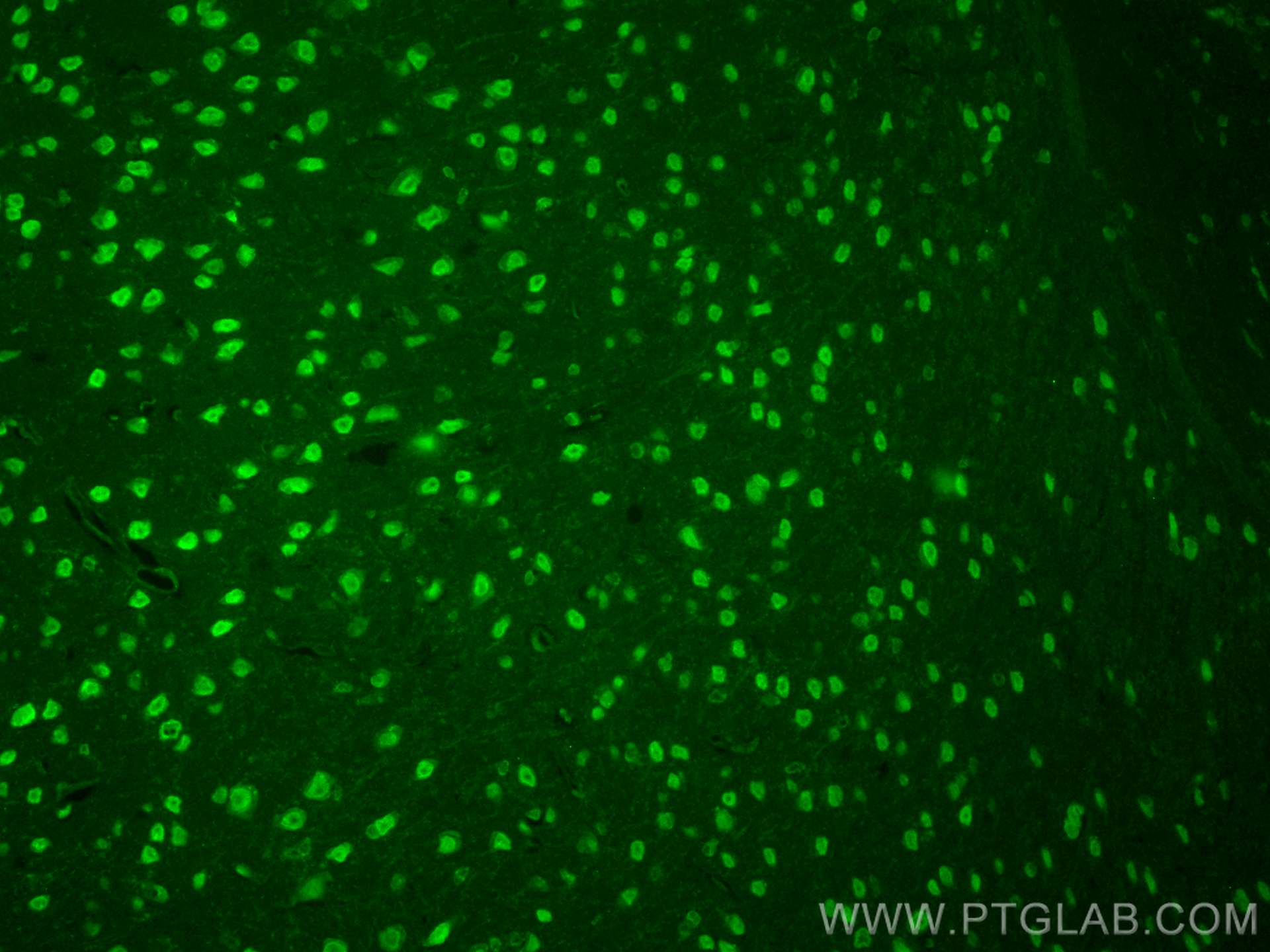 IF Staining of mouse brain using CL488-28180