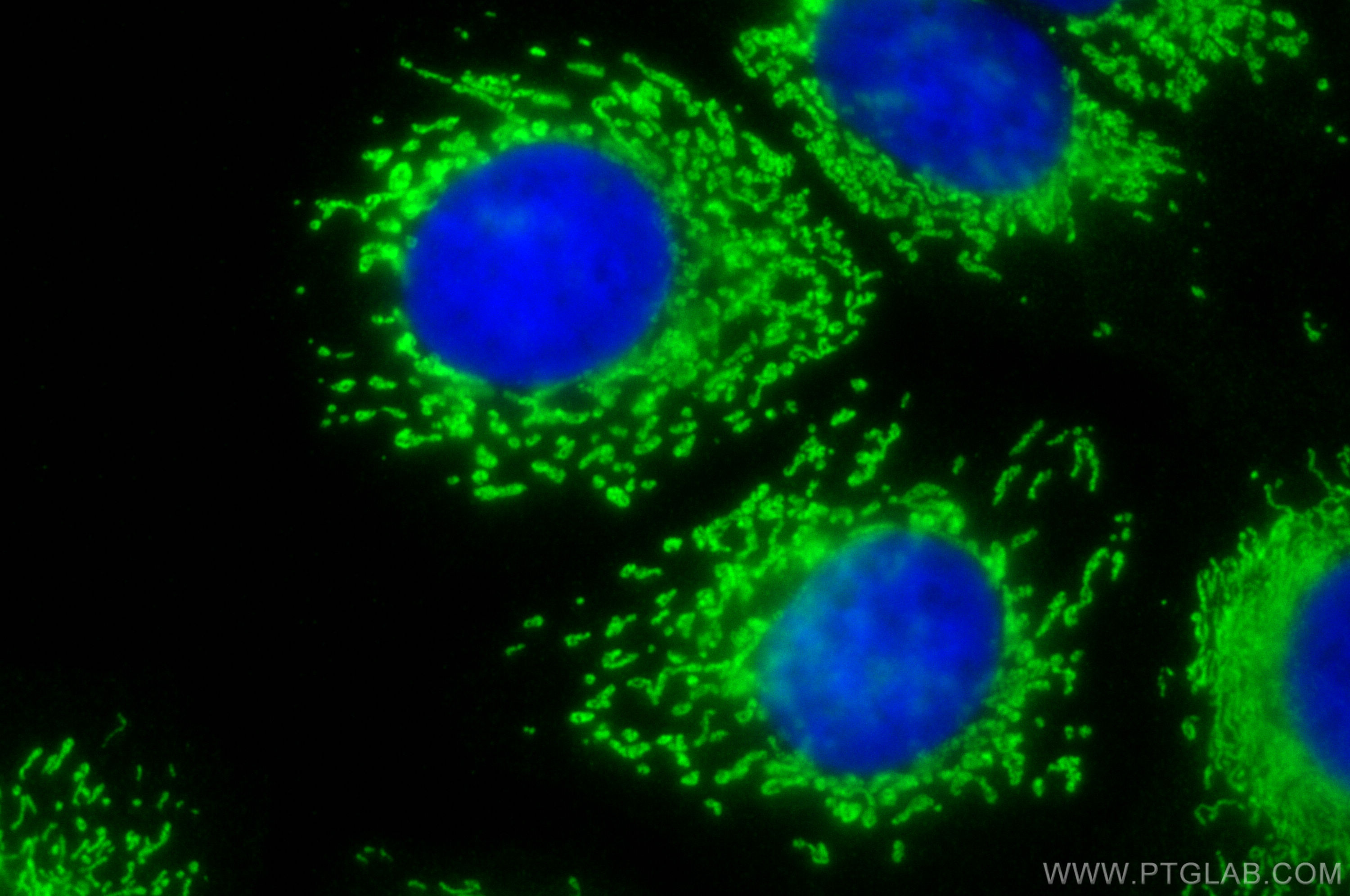 IF Staining of MCF-7 using 18898-1-AP