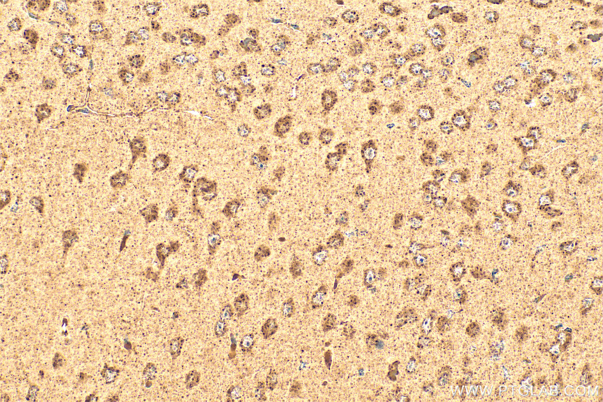 IHC staining of mouse brain using 18898-1-AP