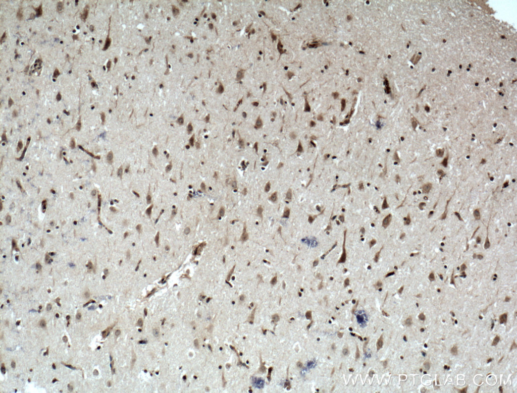 IHC staining of human brain using 12314-1-AP