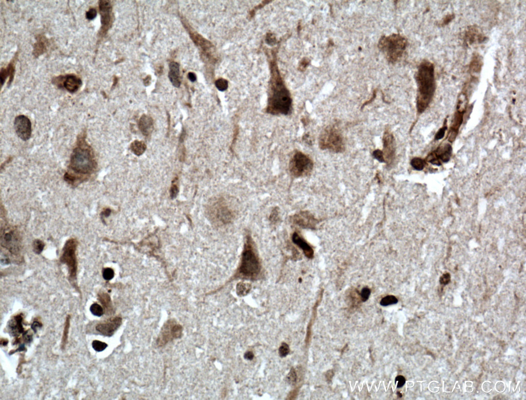 IHC staining of human brain using 12314-1-AP