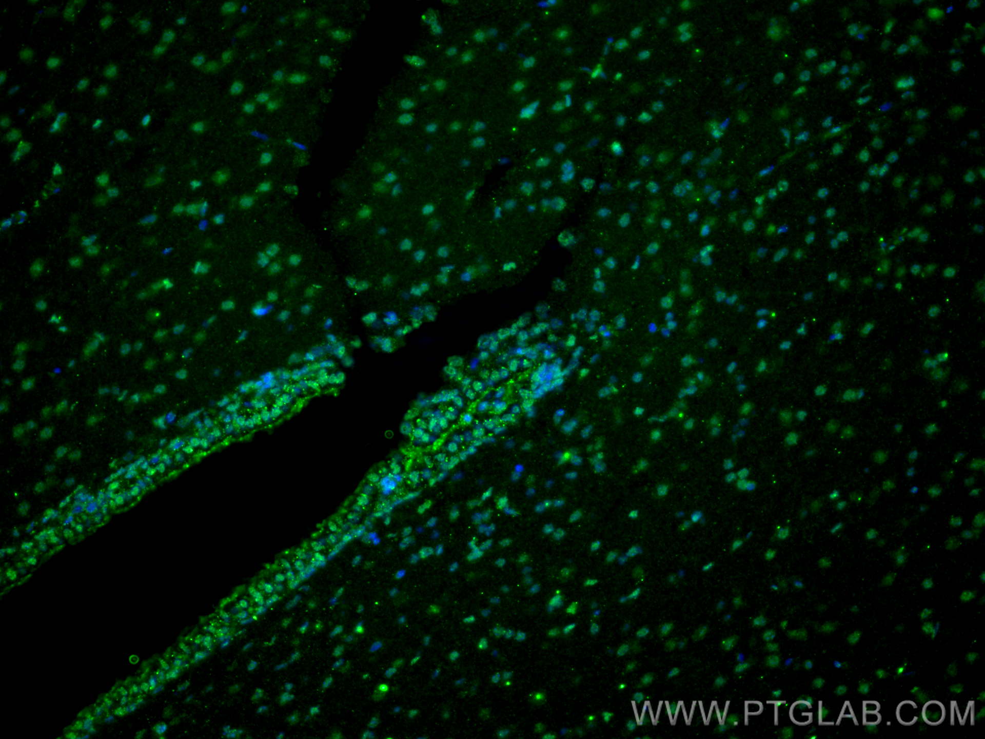 IF Staining of rat brain using 66642-1-Ig (same clone as 66642-1-PBS)