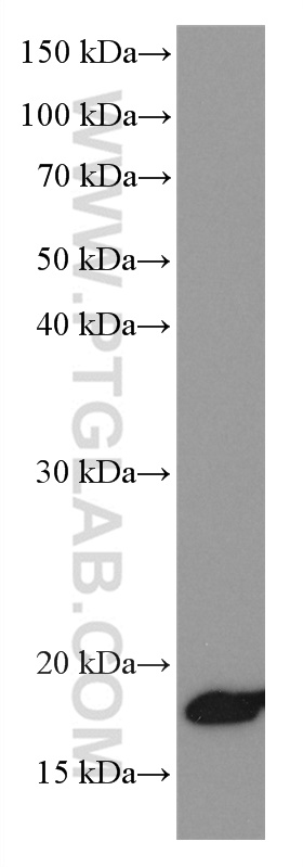 WB analysis of HEK-293 using 66642-1-Ig (same clone as 66642-1-PBS)