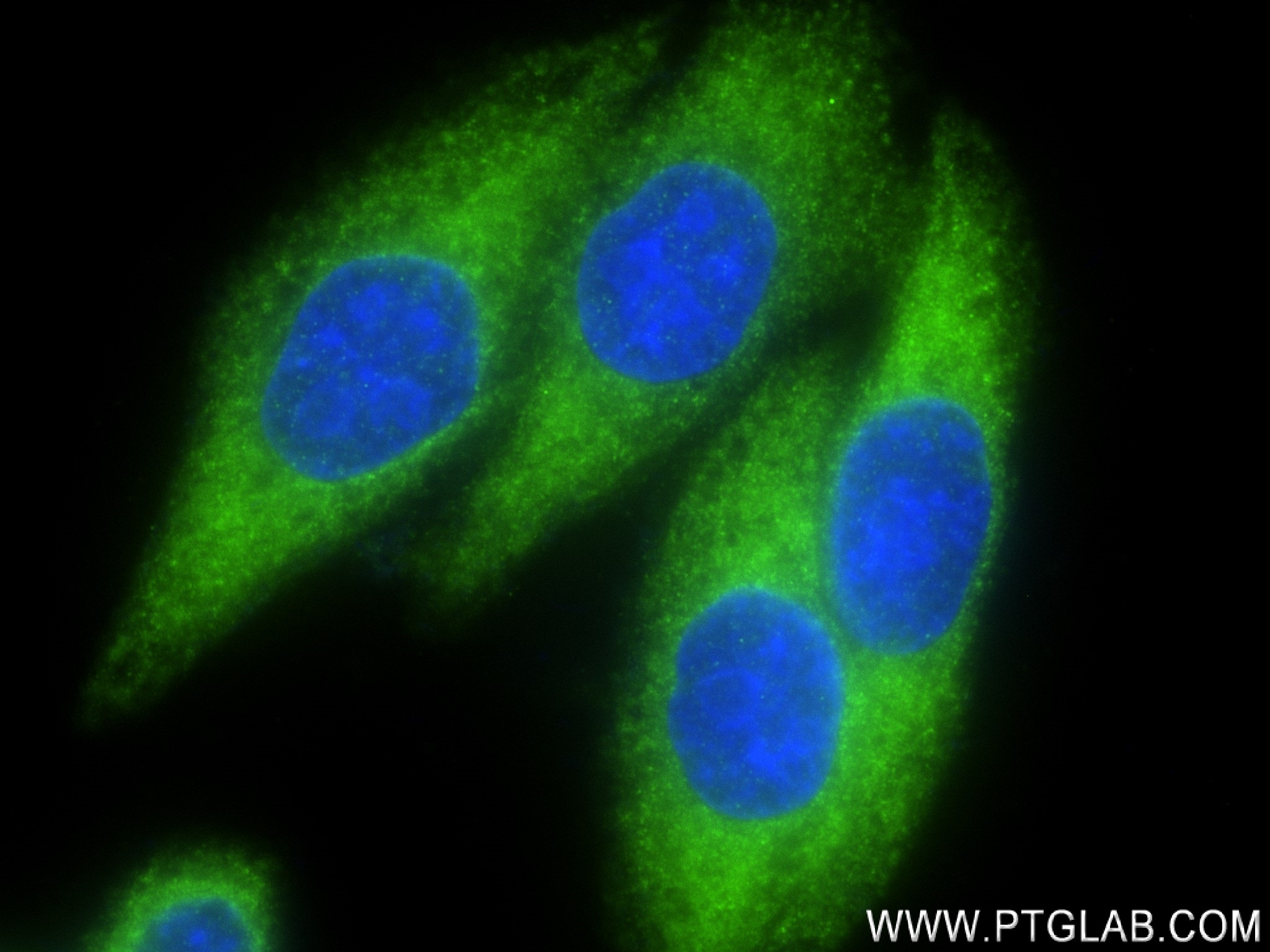 IF Staining of HepG2 using 80979-1-RR (same clone as 80979-1-PBS)