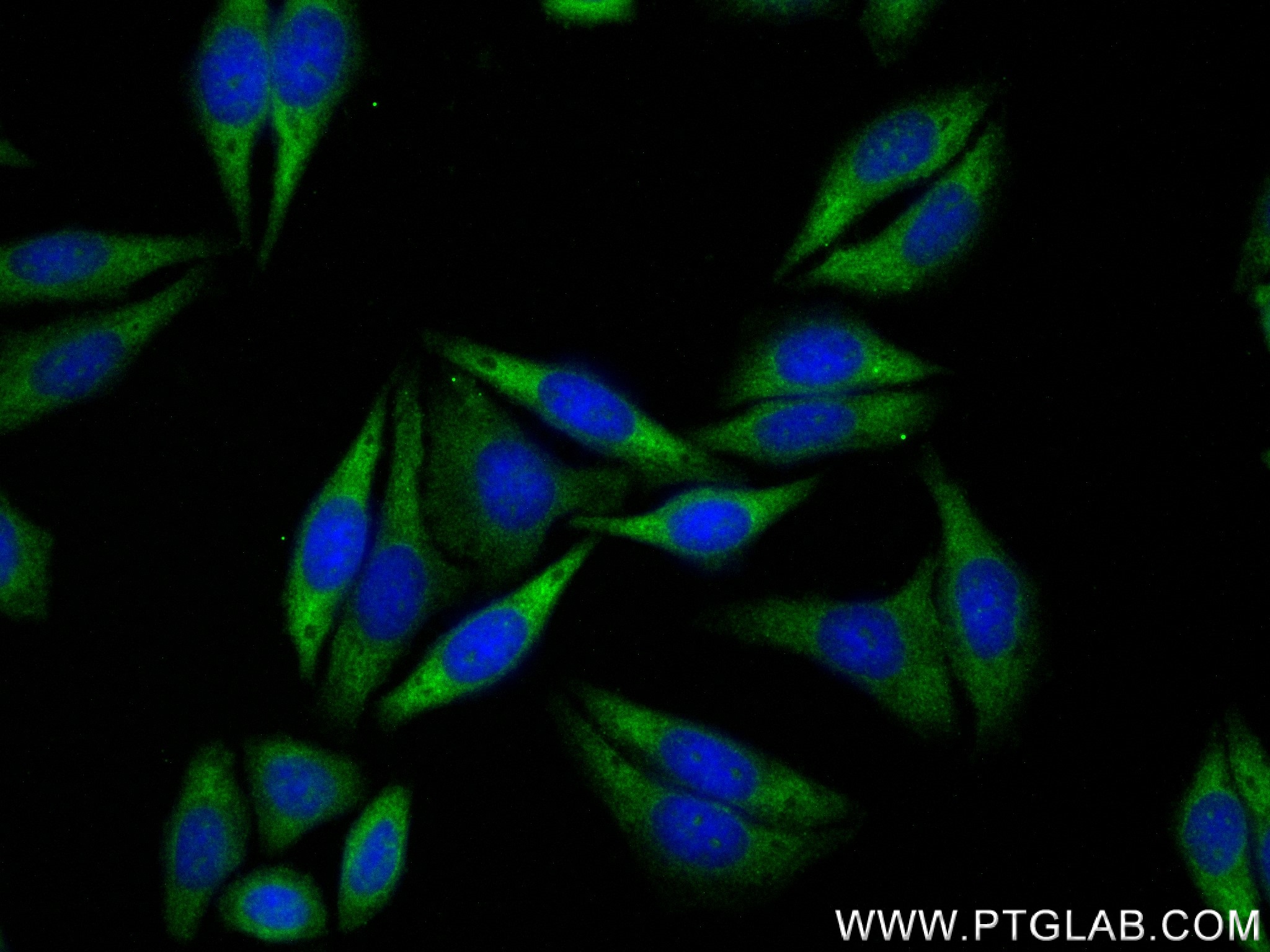 IF Staining of HepG2 using 80979-1-RR (same clone as 80979-1-PBS)