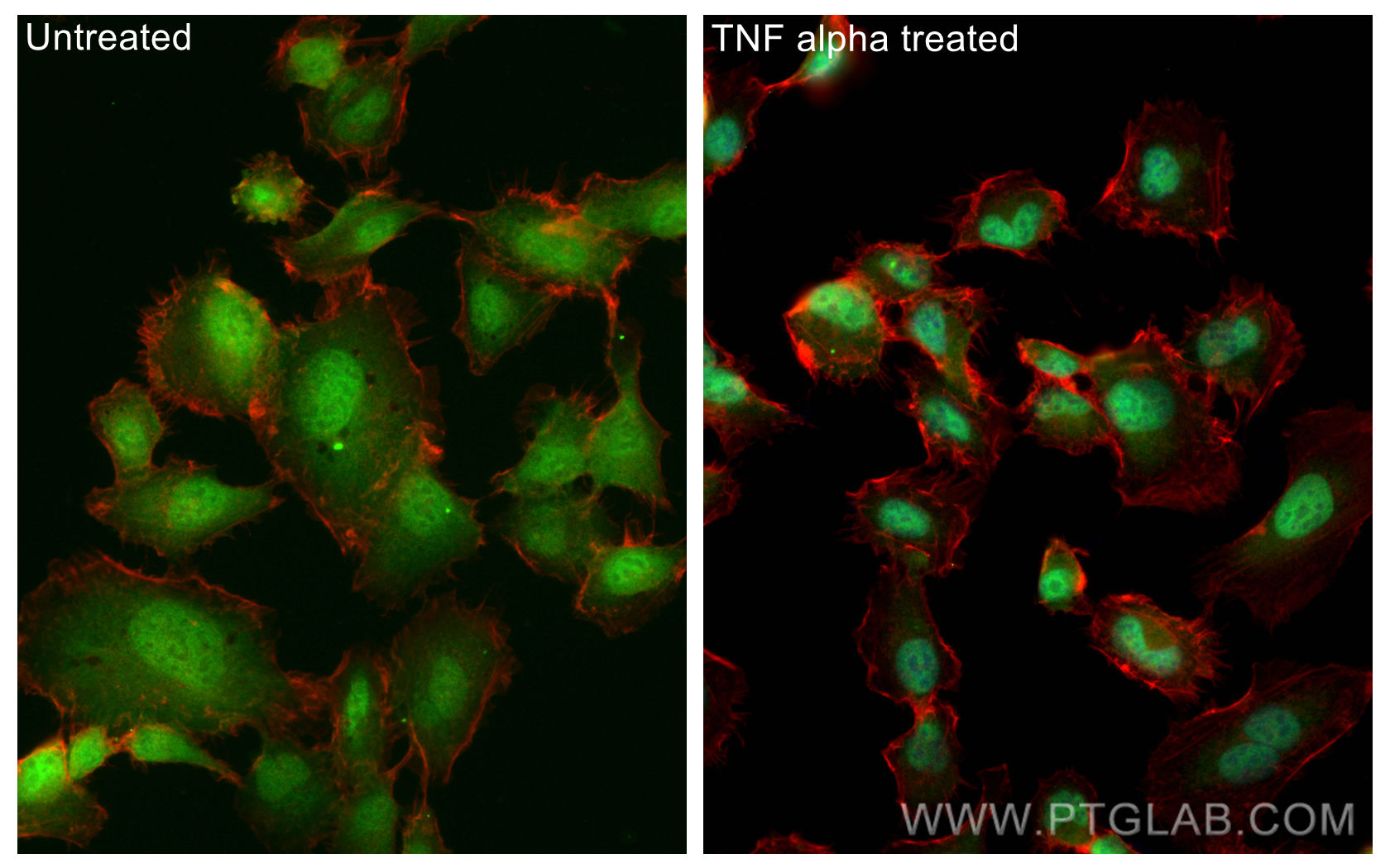 IF Staining of HT-1080 using CL488-80979