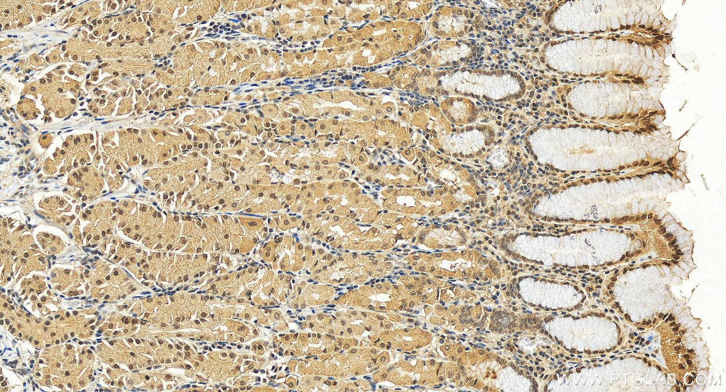 IHC staining of human stomach using 10659-1-AP