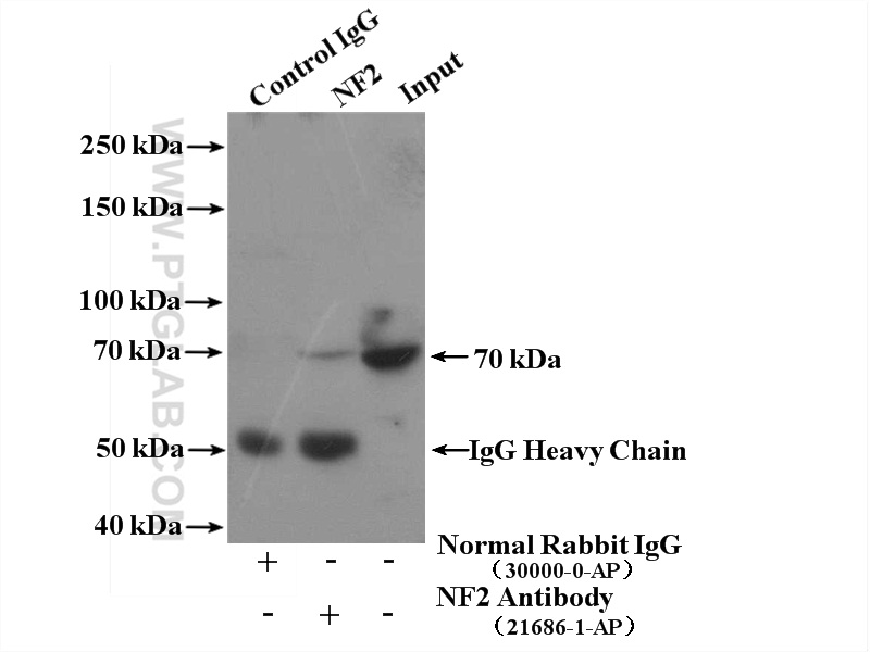 Neurofibromin 2