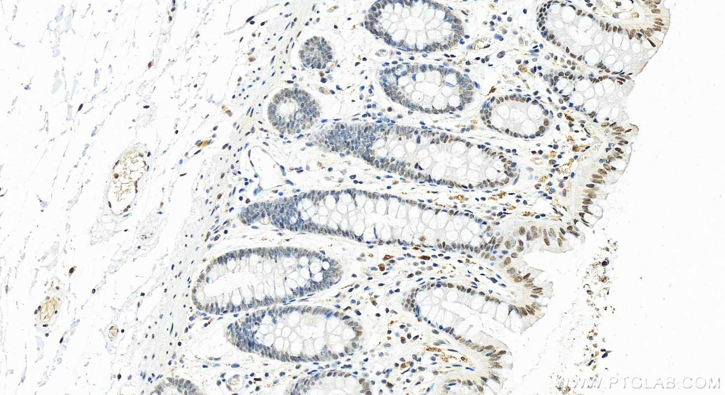 IHC staining of human colon using 24572-1-AP