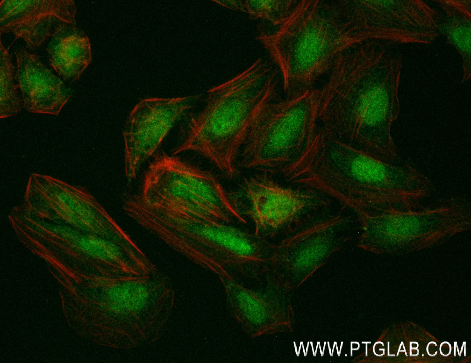 IF Staining of HepG2 using 83987-2-RR (same clone as 83987-2-PBS)