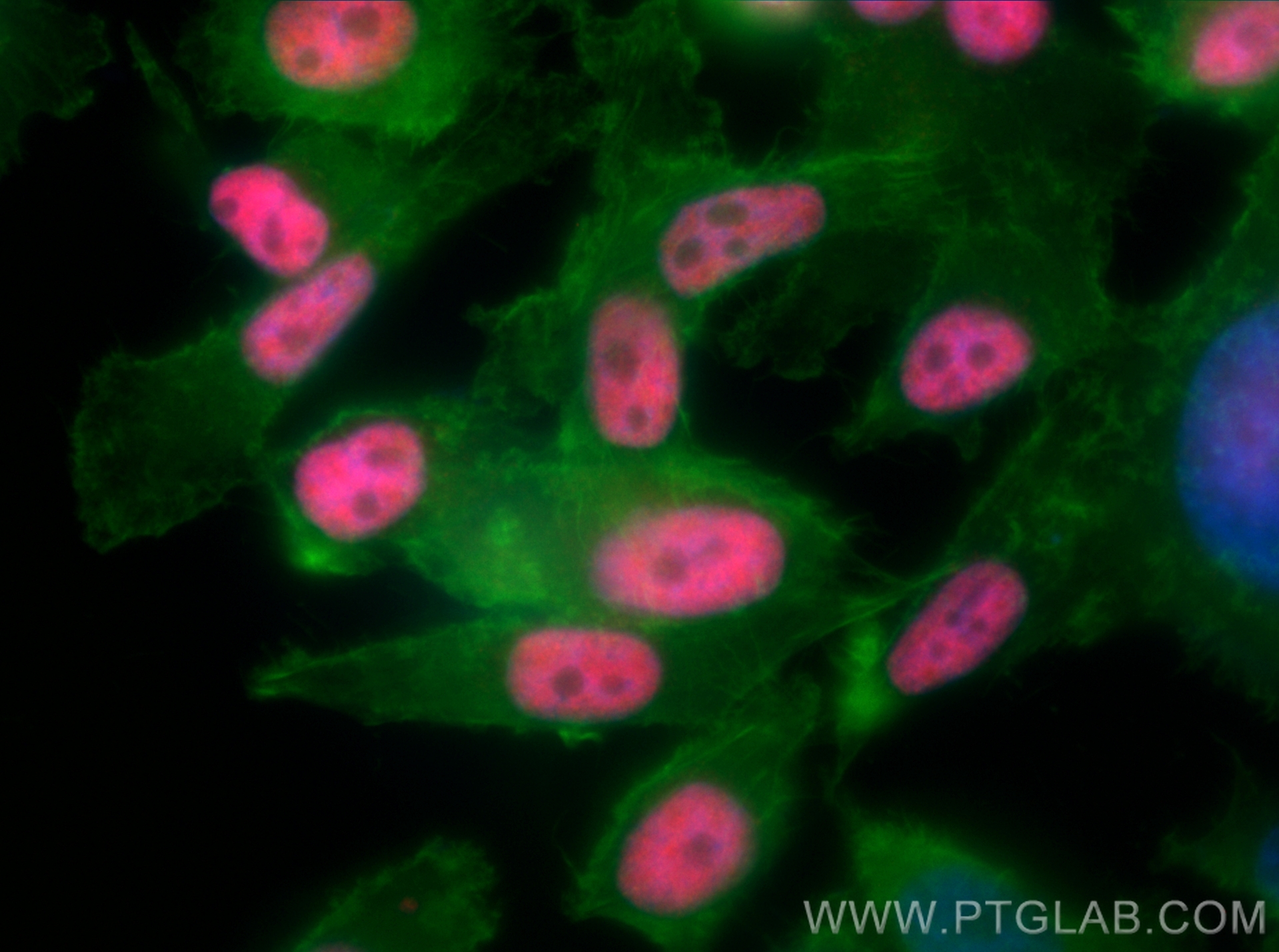 IF Staining of PC-3 using 16399-1-AP