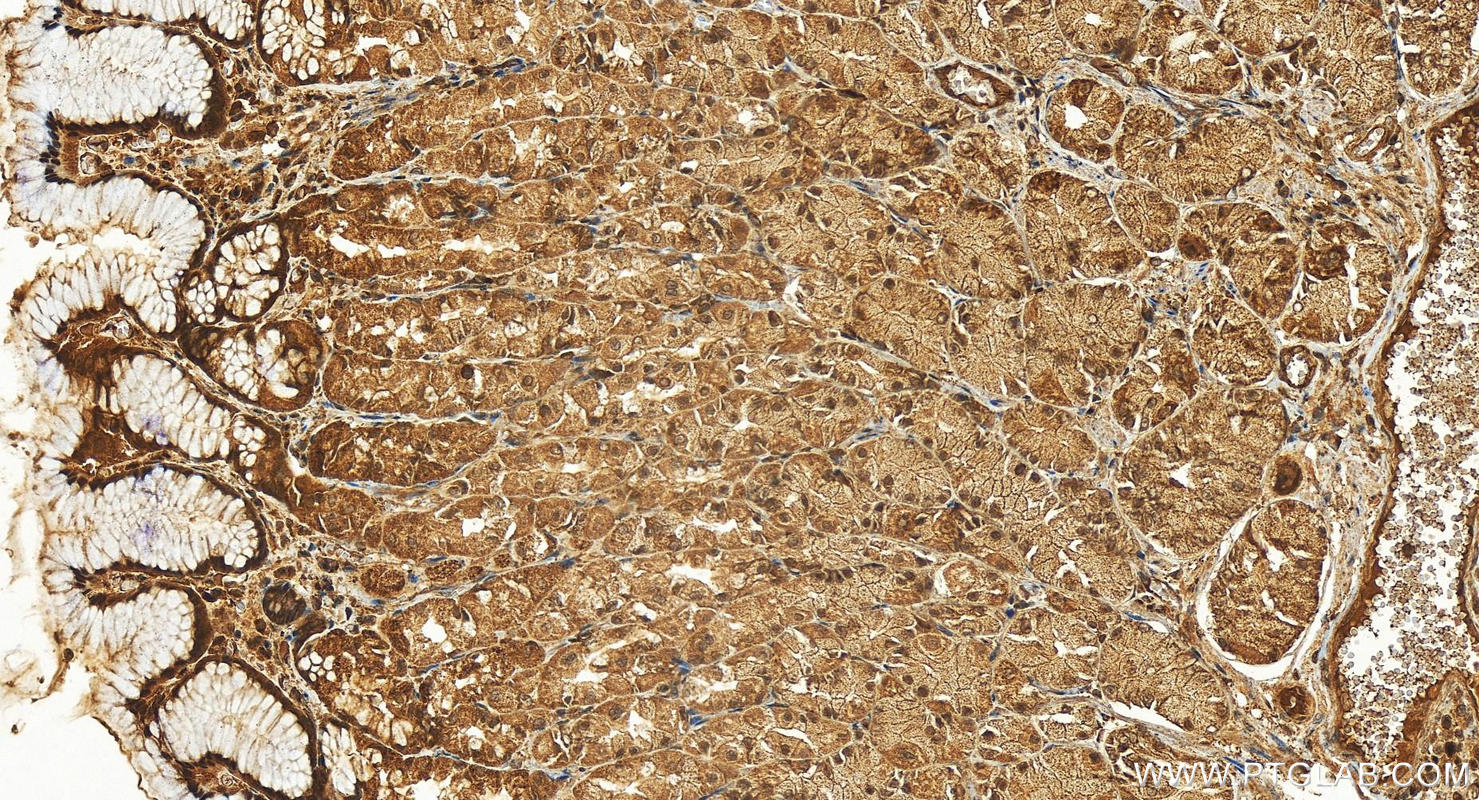 IHC staining of human stomach using 15506-1-AP