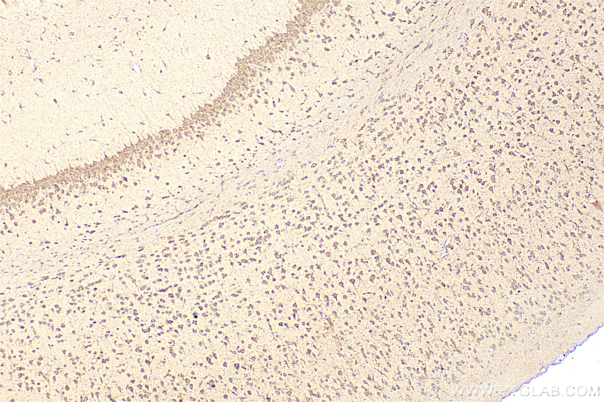 IHC staining of mouse brain using 15506-1-AP