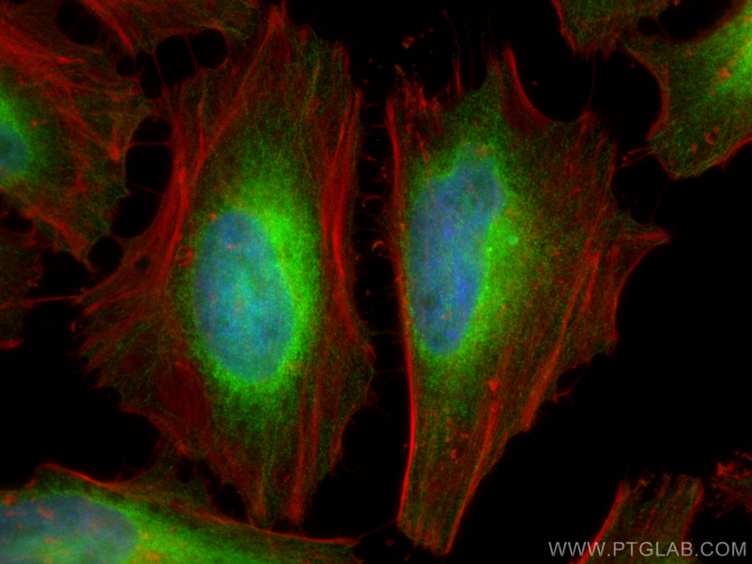 IF Staining of HeLa using 15503-1-AP