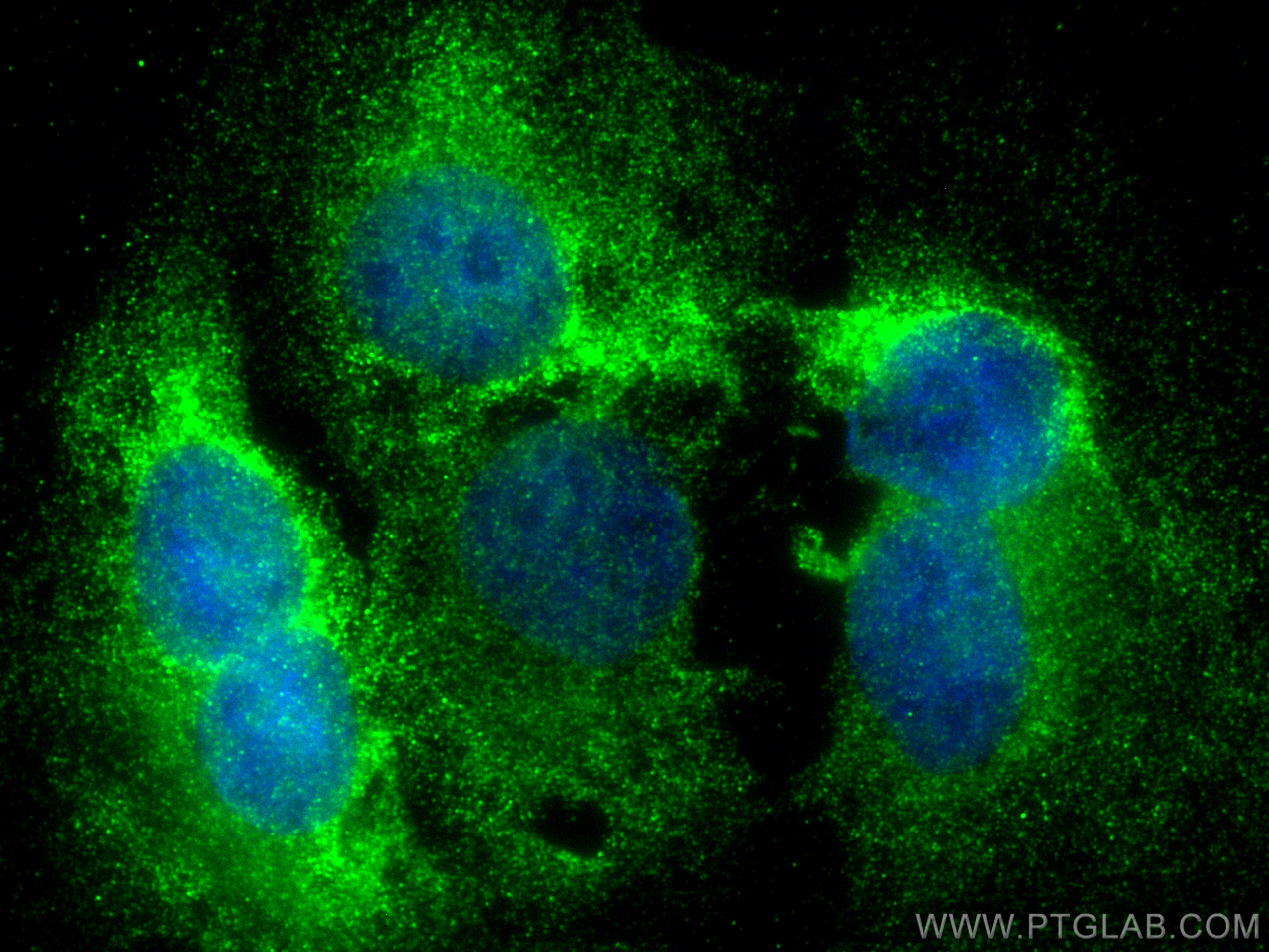 IF Staining of U2OS using 10409-2-AP