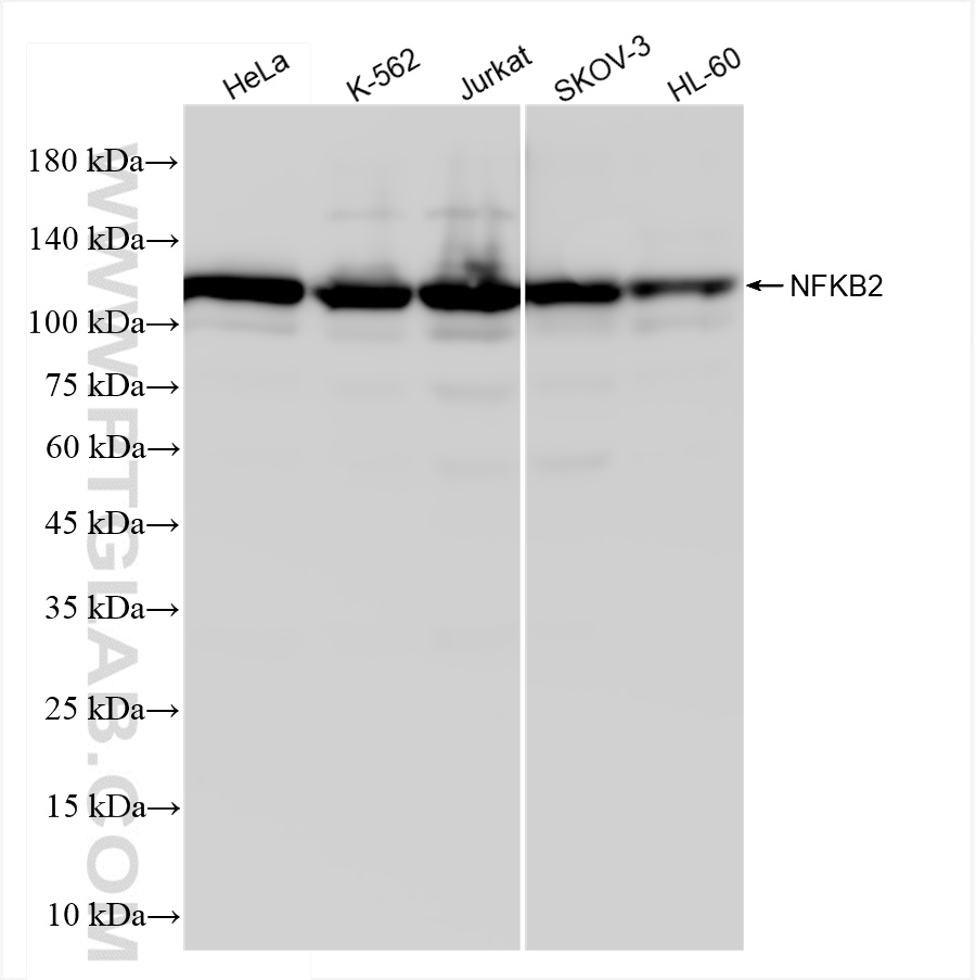 WB analysis using 84022-5-RR