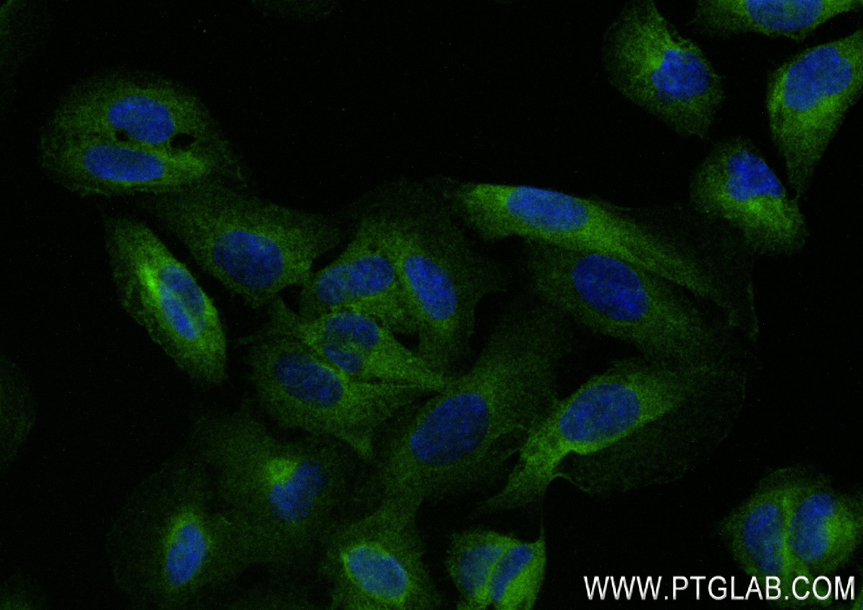 IF Staining of U2OS using 84022-6-RR (same clone as 84022-6-PBS)